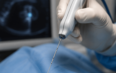 Termoablación con microondas en veterinaria: qué es, cómo funciona y en qué casos está indicada
